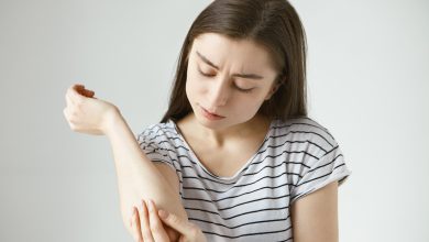 picture of frustrated young dark haired female studying skin on her arm after she fell off bike student girl dressed in stylish striped t shirt looking at her elbow feeling itch or pain